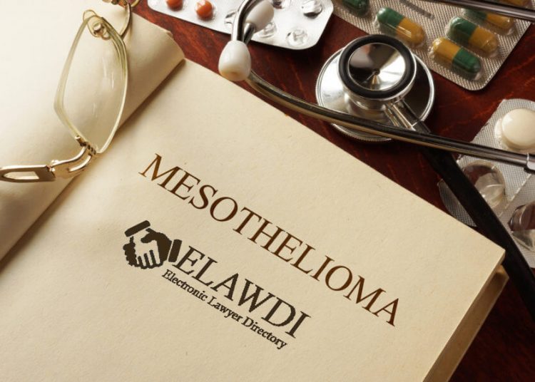 Mesothelioma Law Firms: Providing Compassionate Legal Support